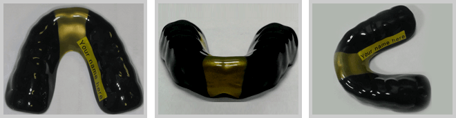 Esher Rugby Mouthguards